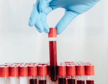 Japanese scientists have developed artificial blood