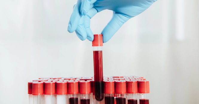 Japanese scientists have developed artificial blood