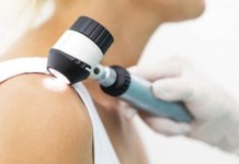 skin cancer