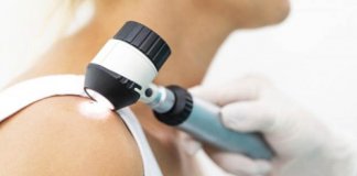 skin cancer