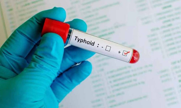 XDR Typhoid