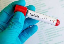 Typhoid Vaccination in Sindh