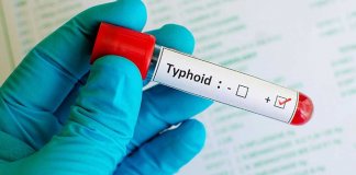 Typhoid Vaccination in Sindh