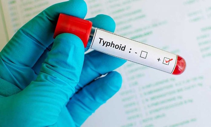 Typhoid Vaccination in Sindh