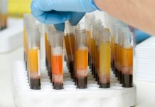 plasma therapy