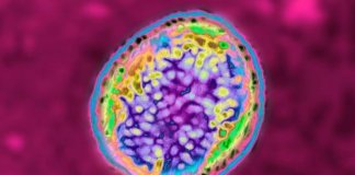 Brucellosis: New Bacteria China