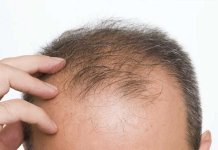 hair growth