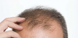 hair growth