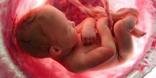 aborted foetus