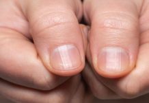 5 Things You Need To Know About 'COVID Nails'