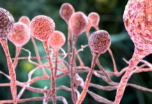 Here's How Black Fungus Is Spreading In Covid-19 Patients