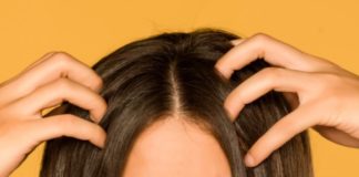remedies treat dry scalp