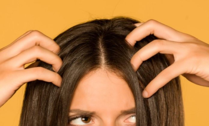 remedies treat dry scalp