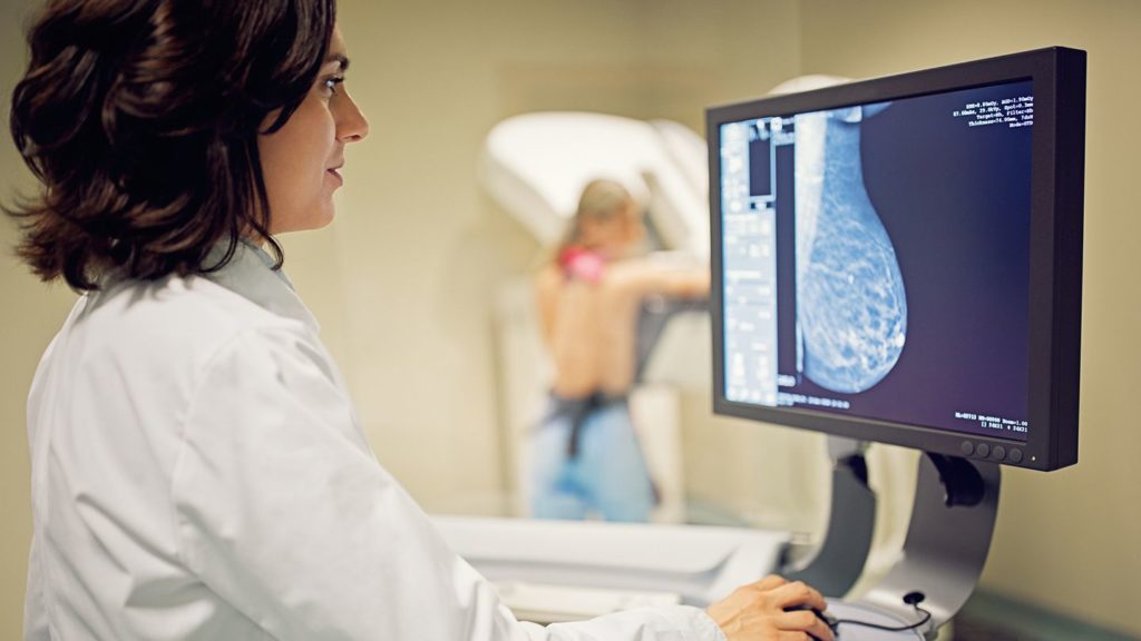 Breast Cancer Myths