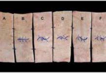 Why Zig-Zag Cuts Heal Differently Than Straight Incisions