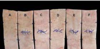 Why Zig-Zag Cuts Heal Differently Than Straight Incisions