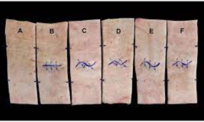 Why Zig-Zag Cuts Heal Differently Than Straight Incisions