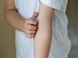 Scientists Finally Cracks What Makes Our Skin Itch