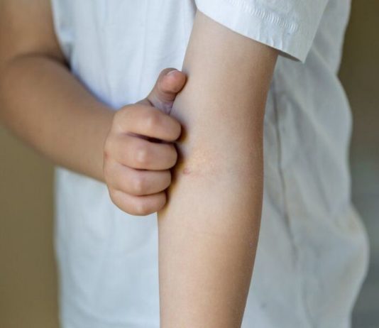 Scientists Finally Cracks What Makes Our Skin Itch