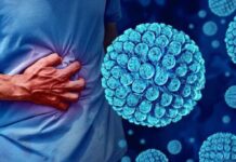 What is Norovirus? Is it Treatable?
