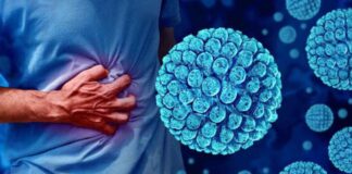 What is Norovirus? Is it Treatable?