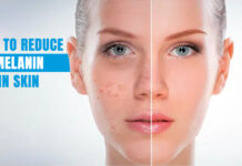 How to Reduce Melanin in Skin