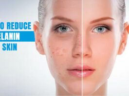 How to Reduce Melanin in Skin