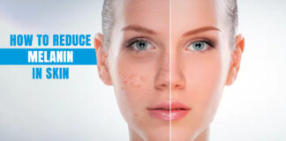 How to Reduce Melanin in Skin