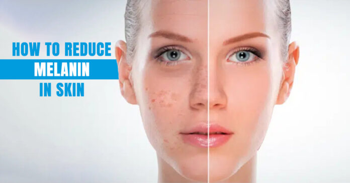 How to Reduce Melanin in Skin