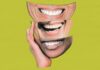 William's Syndrome: A Disorder that Causes You to Be Too Friendly