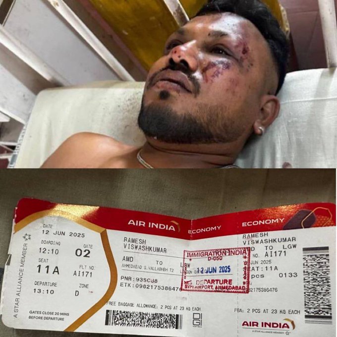 lone-survivor-of-air-india-flight-ai171-crash-who-is-he