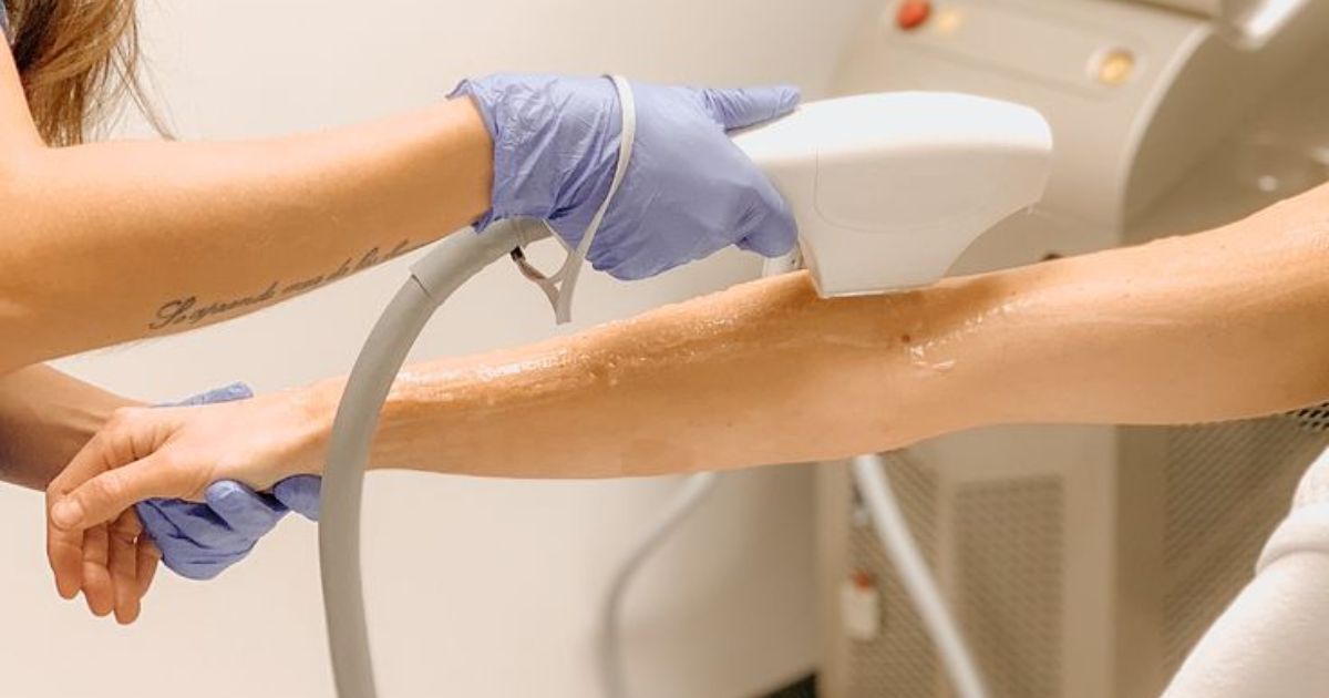 laser-therapy