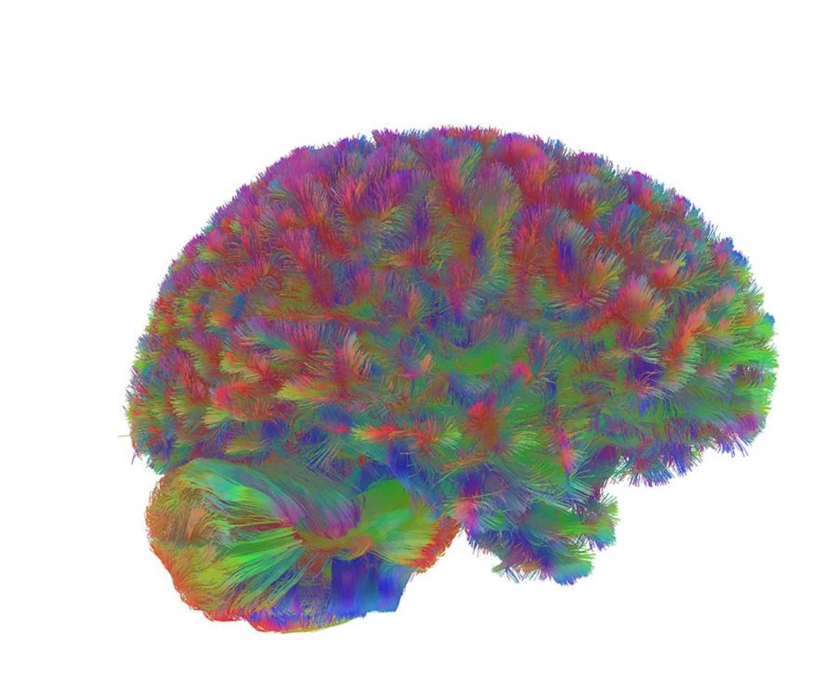 adolescent-brain