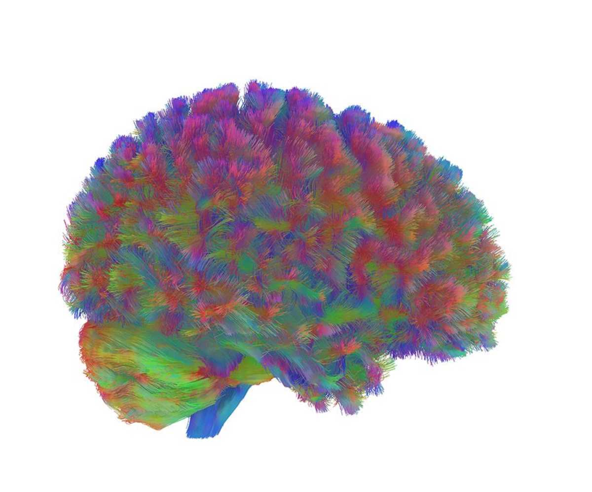 adult-brain
