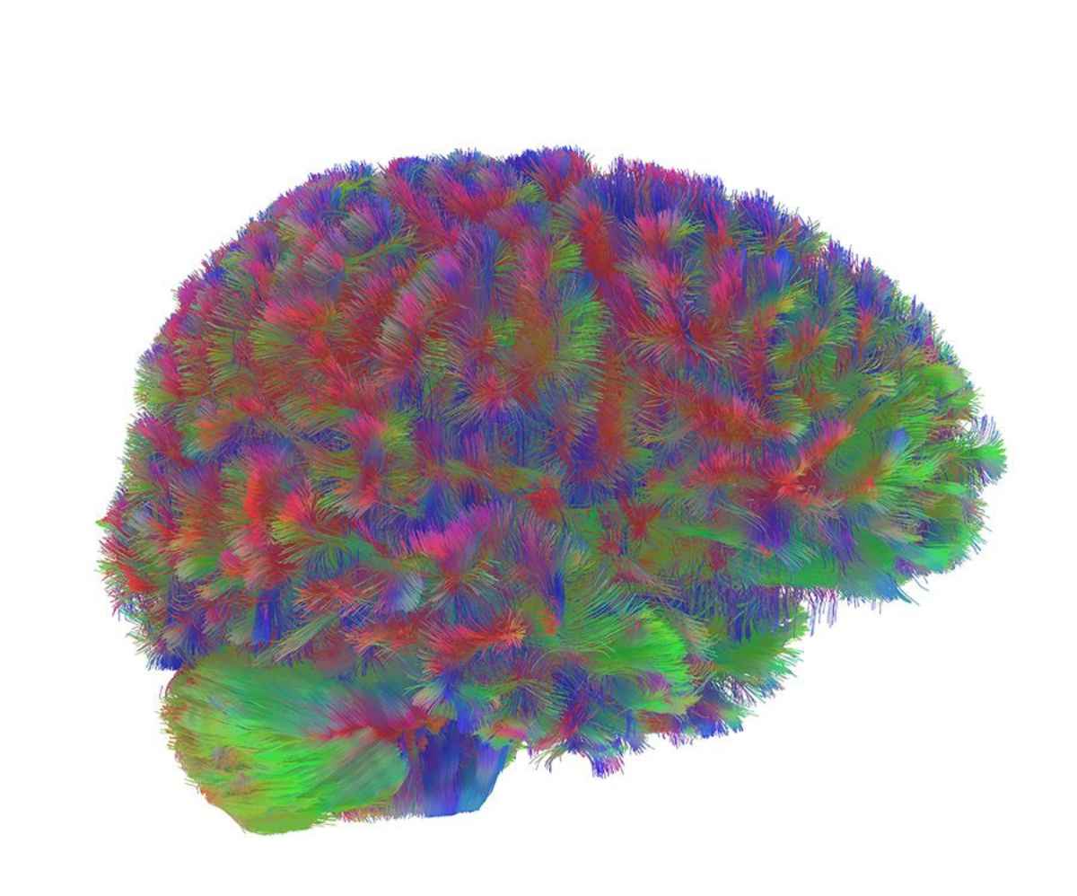 childhood-brain