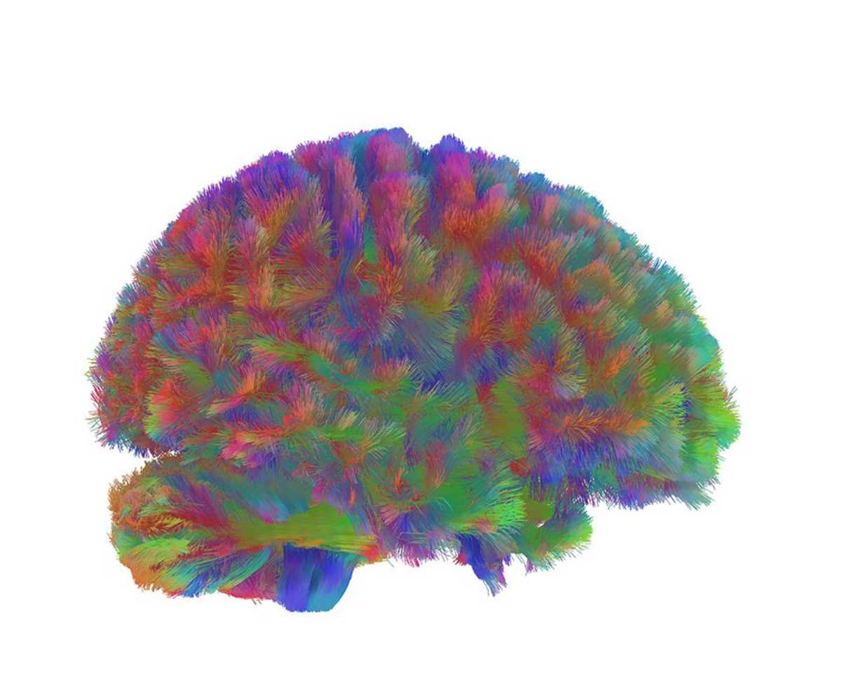 early-ageing-brain
