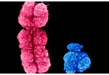 Is The Human Y Chromosome Vanishing? is-the-human-y-chromosome-vanishing
