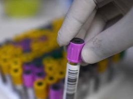 Is the World Facing an HIV Resurgence as Funding Dries Up? HIV epidemic resurgence, global HIV funding cuts, UNAIDS report, HIV prevention programs, PrEP access reductions sub-Saharan Africa, UN 2030 goal to end AIDS, lenacapavir injectable PrEP distribution, international aid reduction global health
