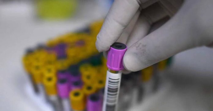 HIV epidemic resurgence, global HIV funding cuts, UNAIDS report, HIV prevention programs, PrEP access reductions sub-Saharan Africa, UN 2030 goal to end AIDS, lenacapavir injectable PrEP distribution, international aid reduction global health