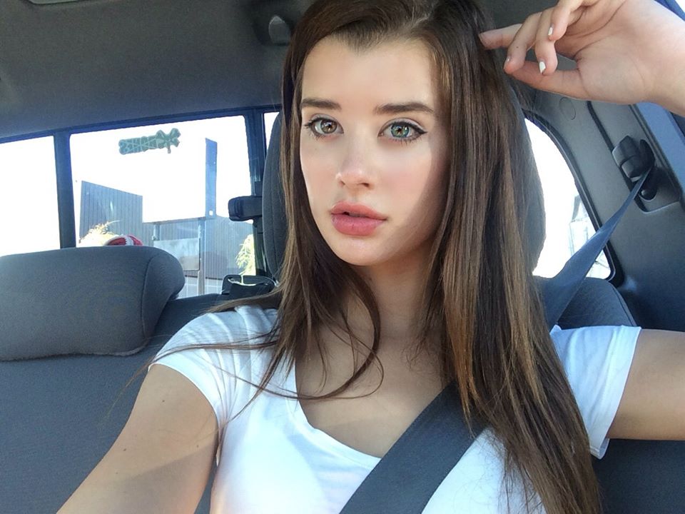 Sarah McDaniel: The US Model With Beautiful Genetic Mutation